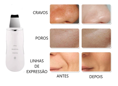MagicFee - Sua limpeza de pele profissional feita em casa.