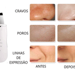 MagicFee - Sua limpeza de pele profissional feita em casa.